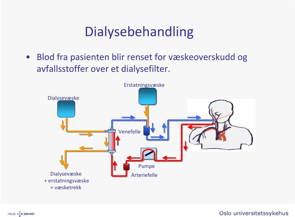 dialysefilter.