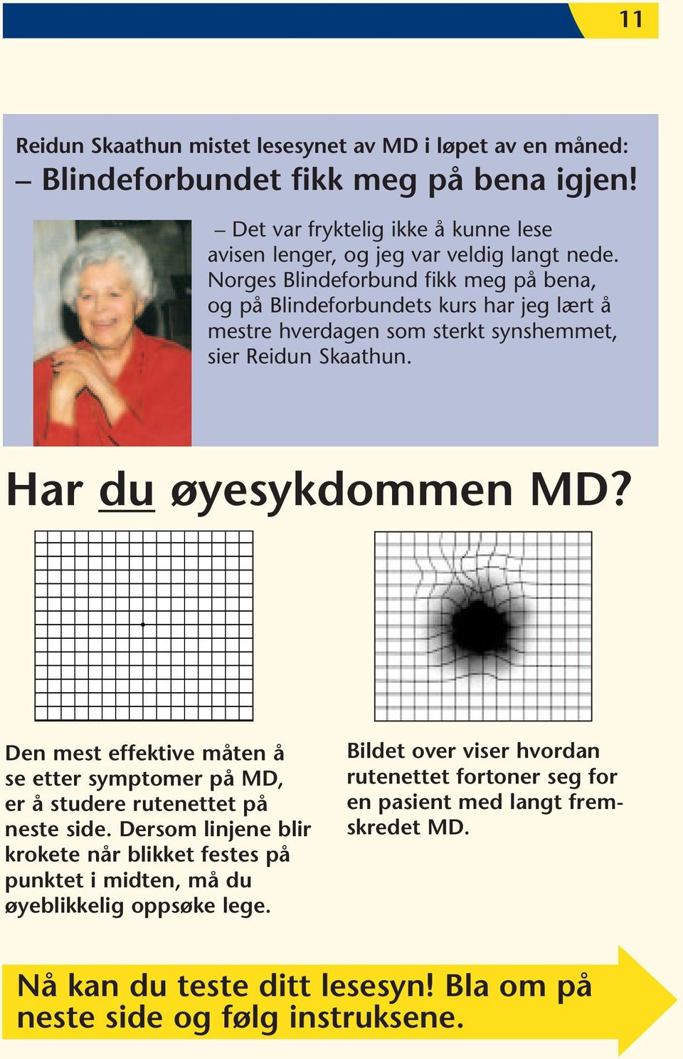 Norges Blindeforbund fikk meg på bena, og på Blindeforbundets kurs har jeg lært å mestre hverdagen som sterkt synshemmet, sier Reidun Skaathun. Har du øyesykdommen MD?