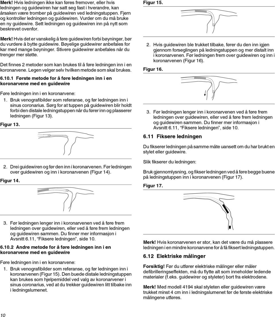 Hvis det er vanskelig å føre guidewiren forbi bøyninger, bør du vurdere å bytte guidewire. Bøyelige guidewirer anbefales for kar med mange bøyninger.