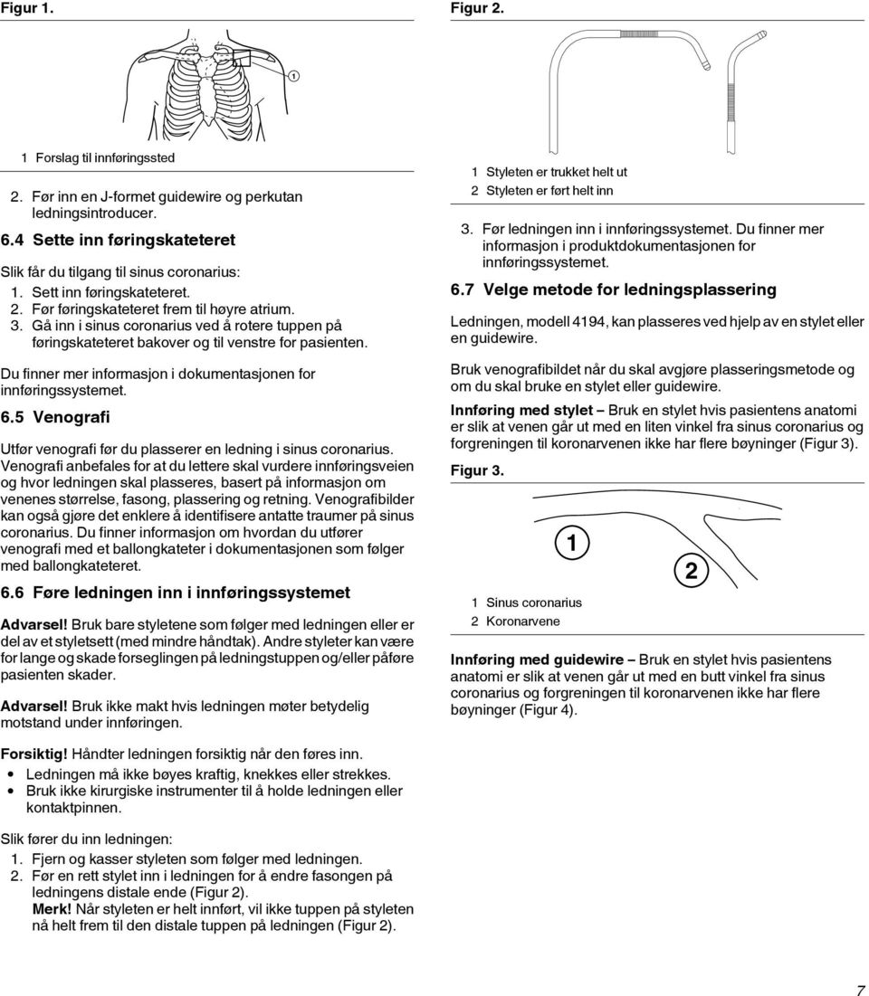 Du finner mer informasjon i dokumentasjonen for innføringssystemet. 6.5 Venografi Utfør venografi før du plasserer en ledning i sinus coronarius.