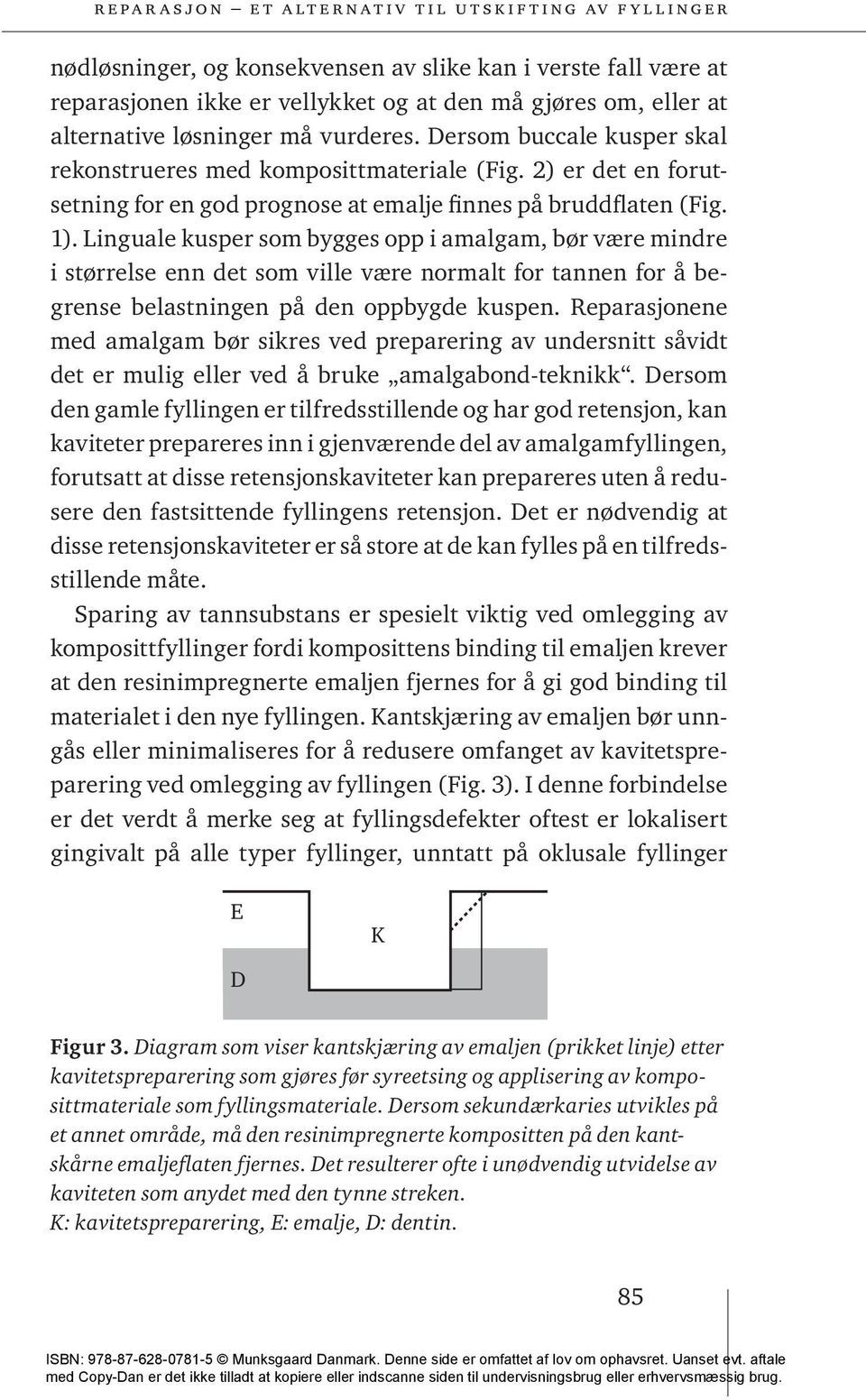 Linguale kusper som bygges opp i amalgam, bør være mindre i størrelse enn det som ville være normalt for tannen for å begrense belastningen på den oppbygde kuspen.