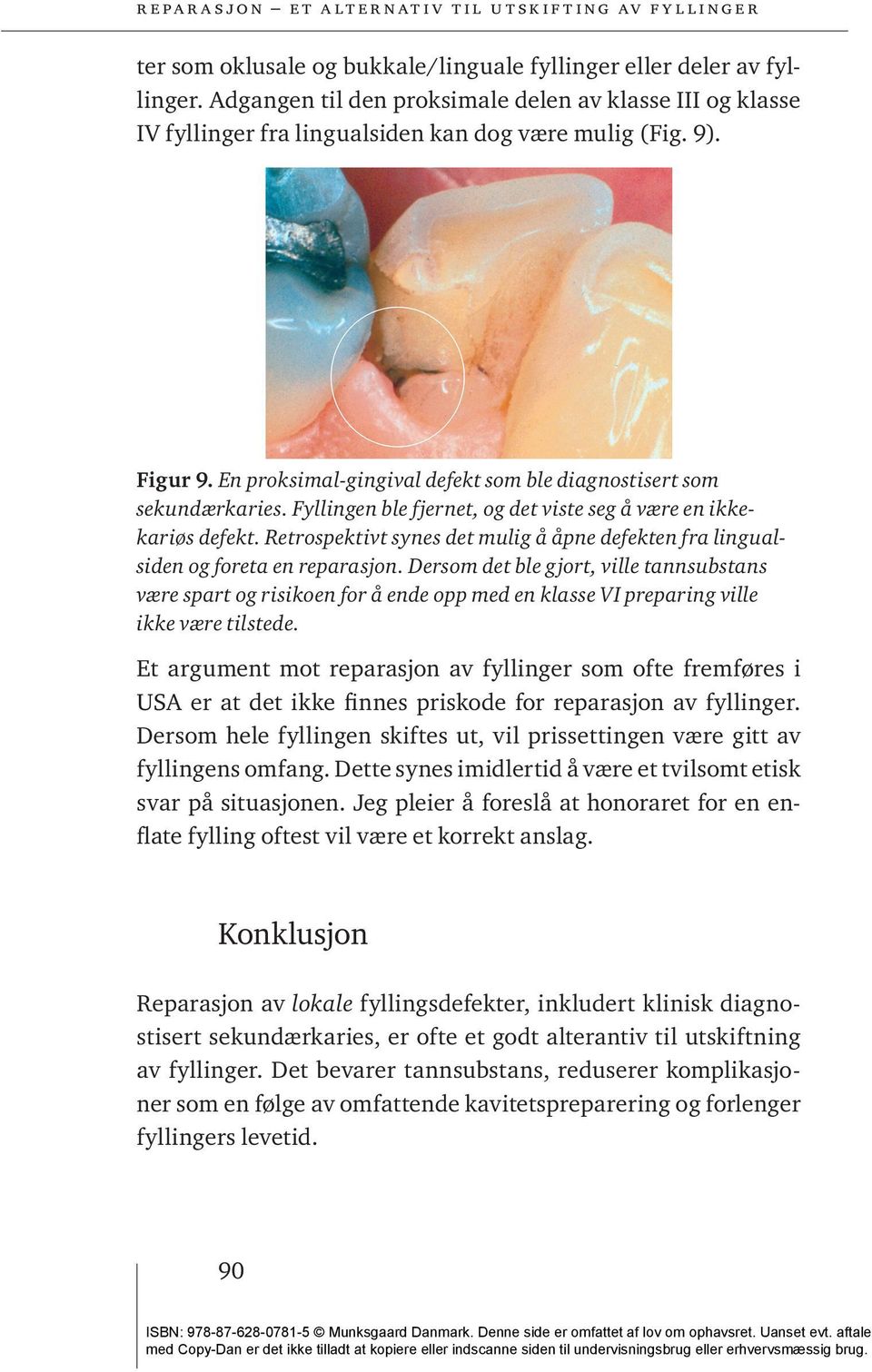 Retrospektivt synes det mulig å åpne defekten fra lingualsiden og foreta en reparasjon.