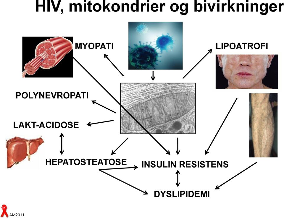 POLYNEVROPATI LAKT-ACIDOSE