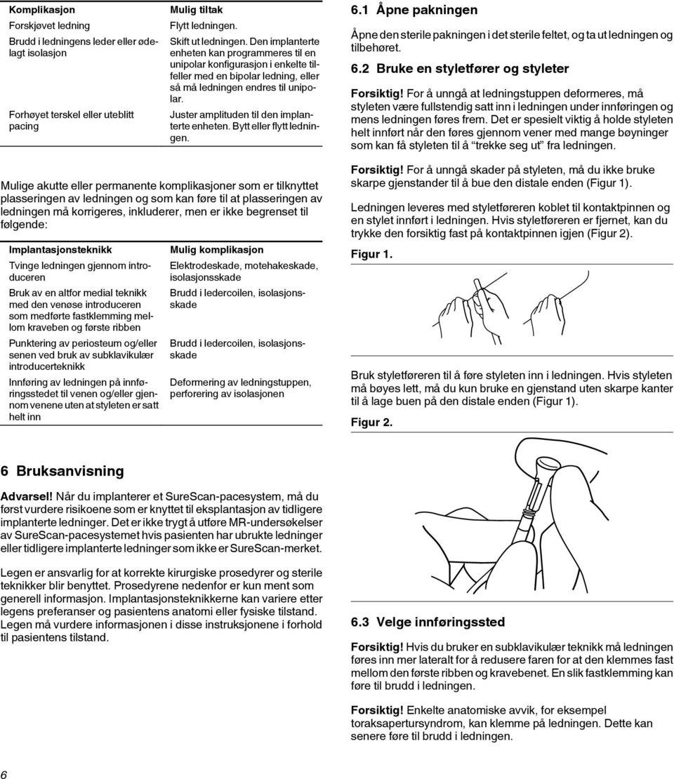 Juster amplituden til den implanterte enheten. Bytt eller flytt ledningen. 6.1 Åpne pakningen Åpne den sterile pakningen i det sterile feltet, og ta ut ledningen og tilbehøret. 6.2 Bruke en styletfører og styleter Forsiktig!