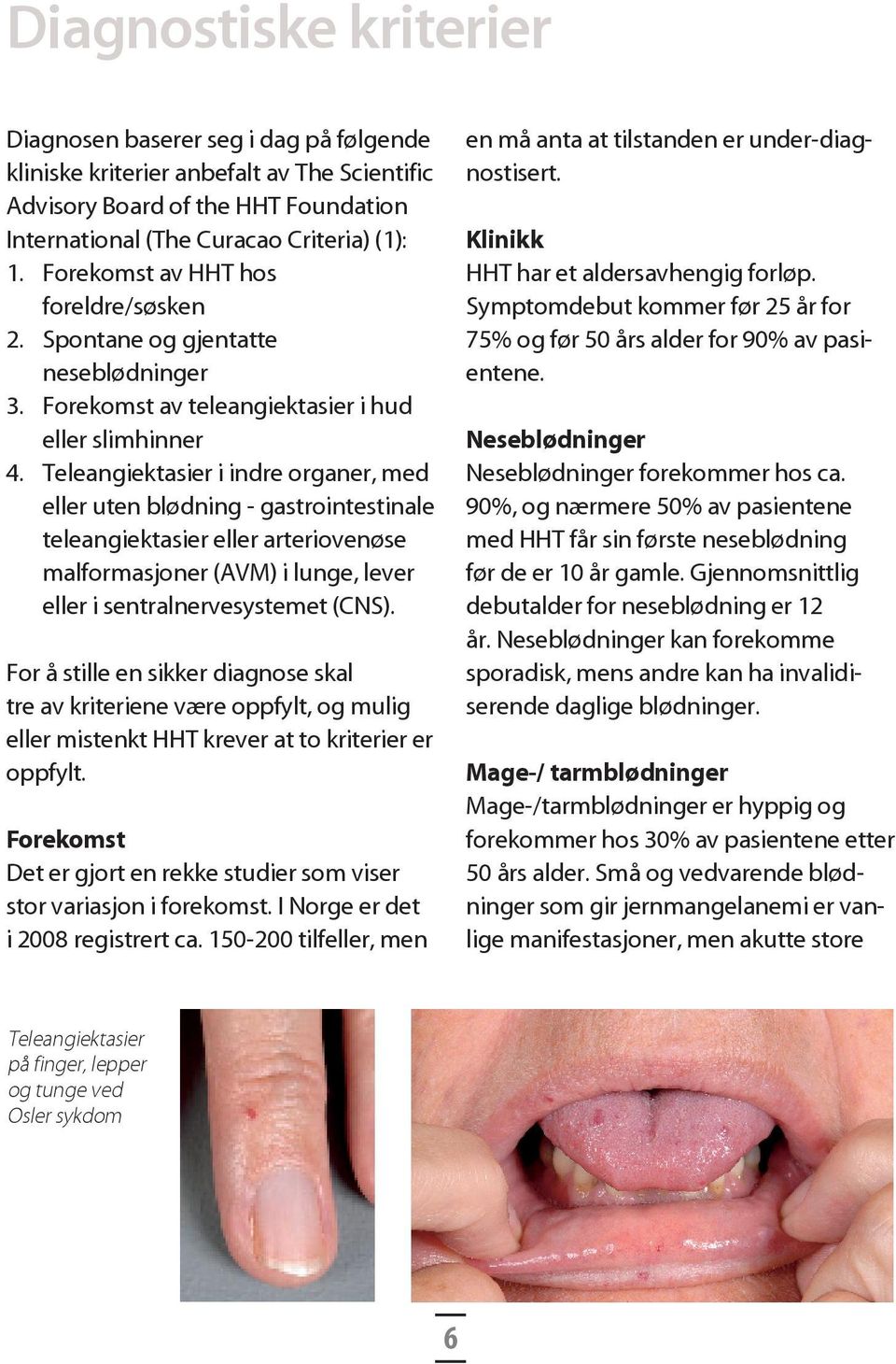 Teleangiektasier i indre organer, med eller uten blødning - gastrointestinale teleangiektasier eller arteriovenøse malformasjoner (AVM) i lunge, lever eller i sentralnervesystemet (CNS).