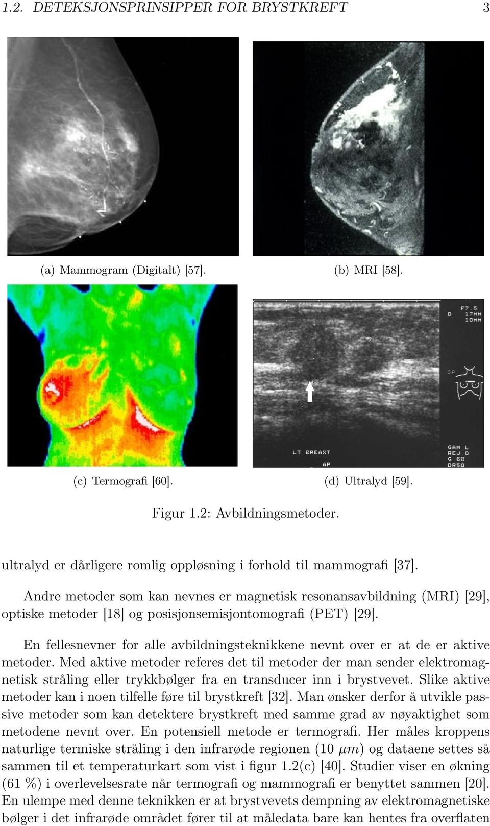 Andre metoder som kan nevnes er magnetisk resonansavbildning (MRI) [29], optiske metoder [18] og posisjonsemisjontomografi (PET) [29].