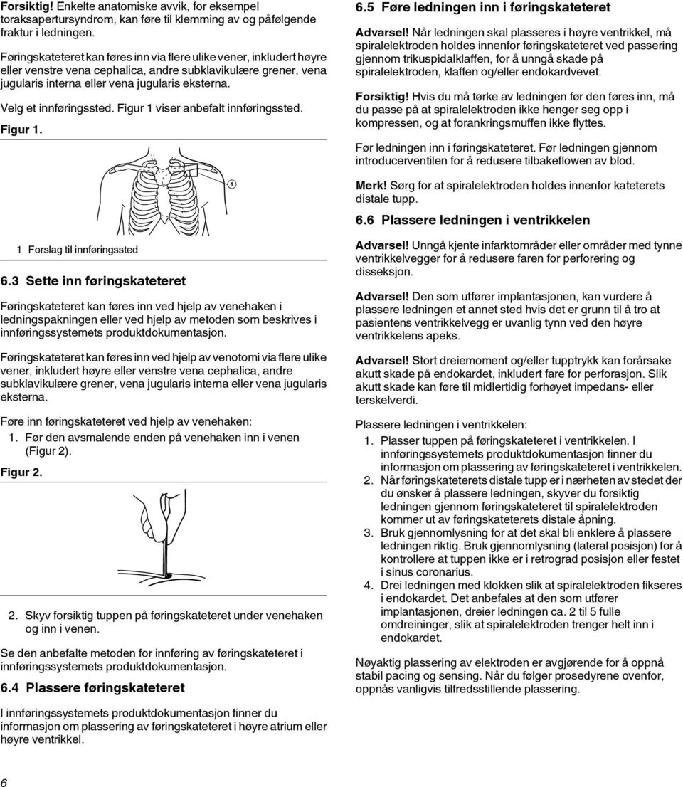 Velg et innføringssted. Figur 1 viser anbefalt innføringssted. Figur 1. 1 Forslag til innføringssted 6.