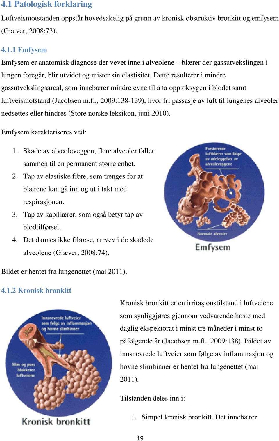 , 2009:138-139), hvor fri passasje av luft til lungenes alveoler nedsettes eller hindres (Store norske leksikon, juni 2010). Emfysem karakteriseres ved: 1.