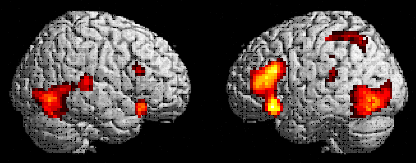 Shift of focus: From area blobology to network connectivity "Passive viewing": Perception (A)