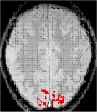 , Science, 1991 First fmri study in Norway 1994. Lundervold,. Hugdahl,. Ersland,. et al. Int. J.