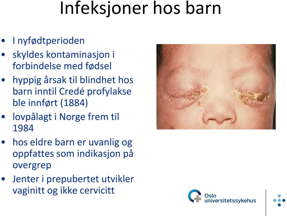 (1884) lovpålagt i Norge frem til 1984 hos eldre barn er uvanlig og oppfattes