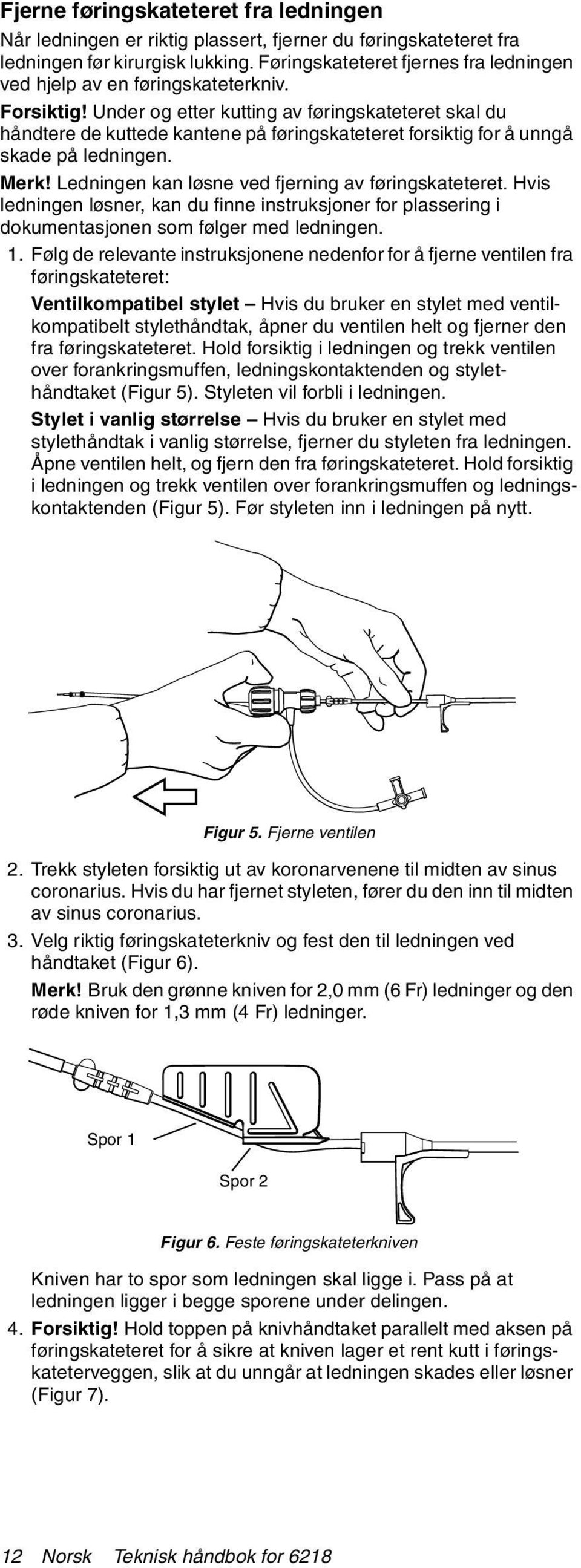 Under og etter kutting av føringskateteret skal du håndtere de kuttede kantene på føringskateteret forsiktig for å unngå skade på ledningen. Merk! Ledningen kan løsne ved fjerning av føringskateteret.