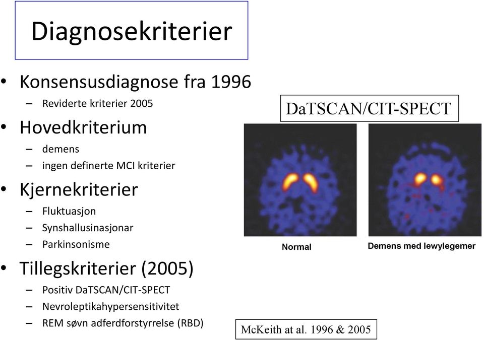 Tillegskriterier (2005) Positiv DaTSCAN/CIT-SPECT Nevroleptikahypersensitivitet REM søvn