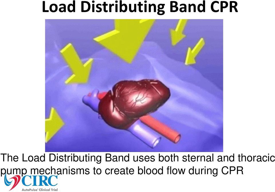 sternal and thoracic pump