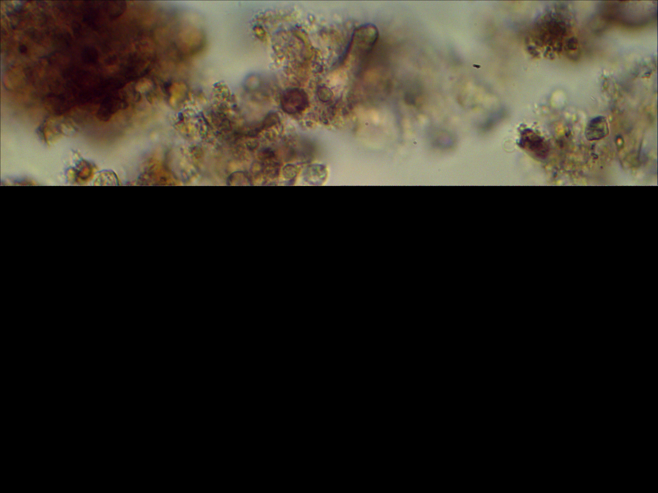 Protozoer Protozoer tot (% felt) bør være > 20% (4) helst mere enn en organismegruppe, helst også med ulike organismer