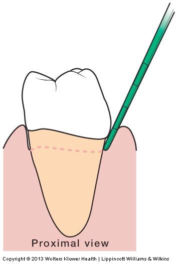 Fundamentals of Periodontal Instrumentation &