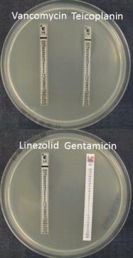 OVERFØRBAR LINEZOLIDRESISTENS (1) cfr (chloramphenicol-florfenicol resistance) gen Koder for metyltransferase som katalyserer metylering av A2503 i 23S rrna V domenet Ofte på plasmider med andre