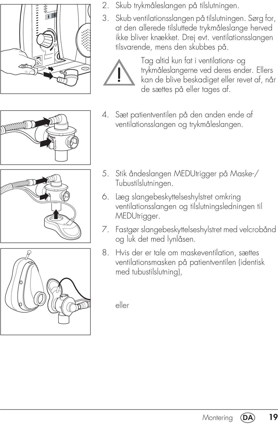 Ellers kan de blive beskadiget eller revet af, når de sættes på eller tages af. 4. Sæt patientventilen på den anden ende af ventilationsslangen og trykmåleslangen. 5.