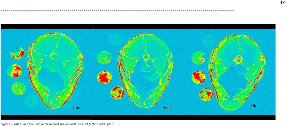 MR bilder fra ulike deler