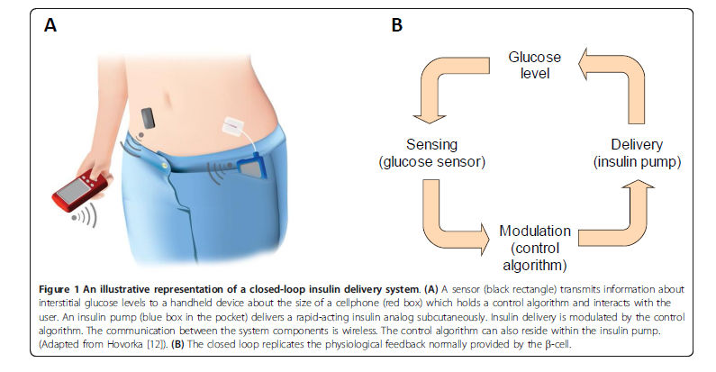 BMJ 2007 Bedret monitorering? Closed loop: Begrense vektøkning: viktig for perinatal morbiditet i T2DM svangerskap? 17 women (29%) gained 5 kg, and 41 gained >5 kg. Median GWG was 3.7 kg (-4.