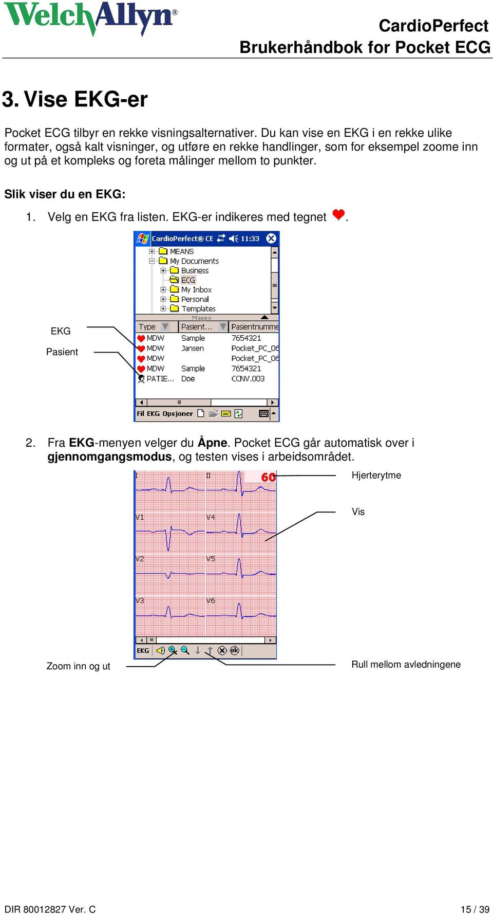 et kompleks og foreta målinger mellom to punkter. Slik viser du en EKG: 1. Velg en EKG fra listen. EKG-er indikeres med tegnet.