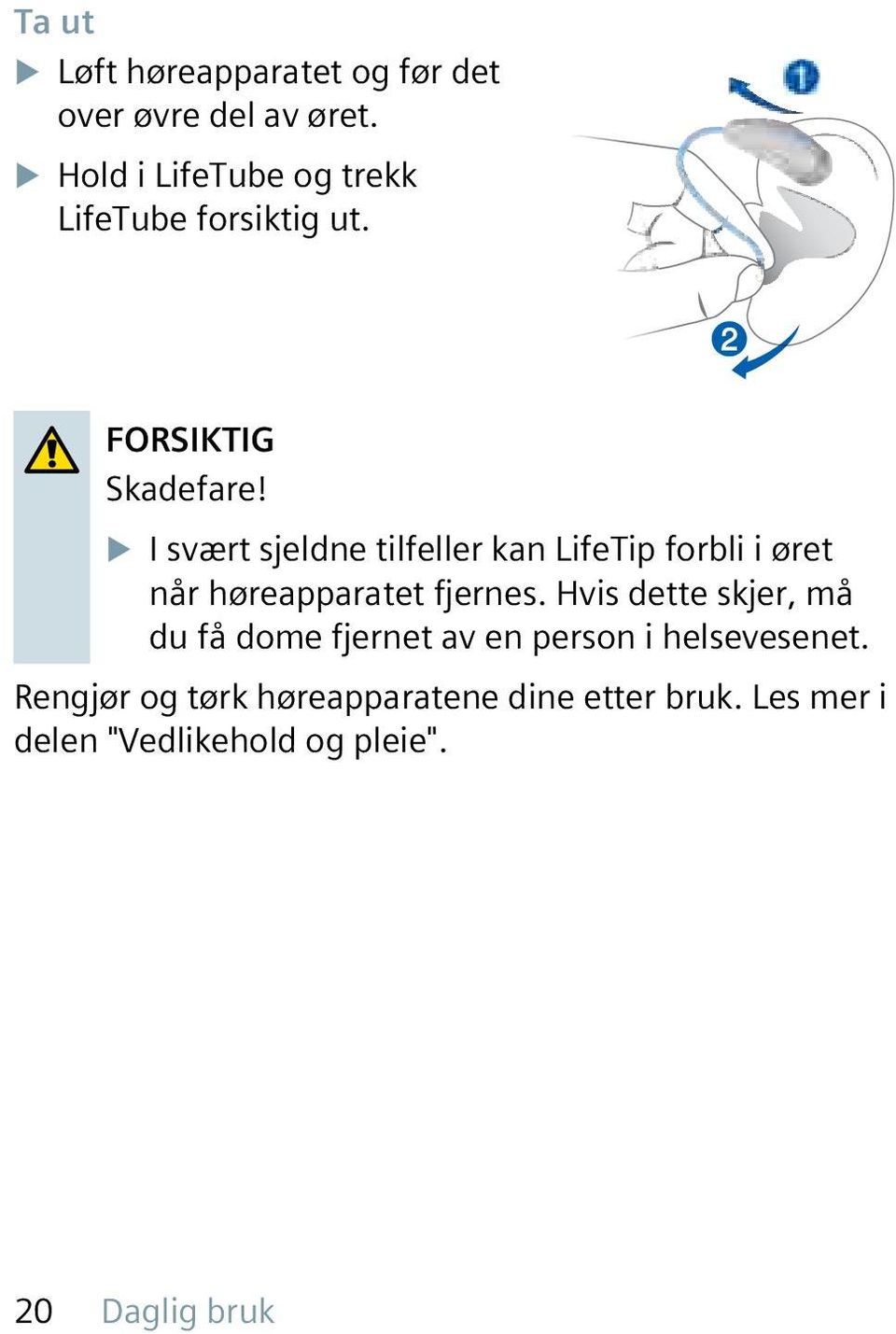 u I svært sjeldne tilfeller kan LifeTip forbli i øret når høreapparatet fjernes.