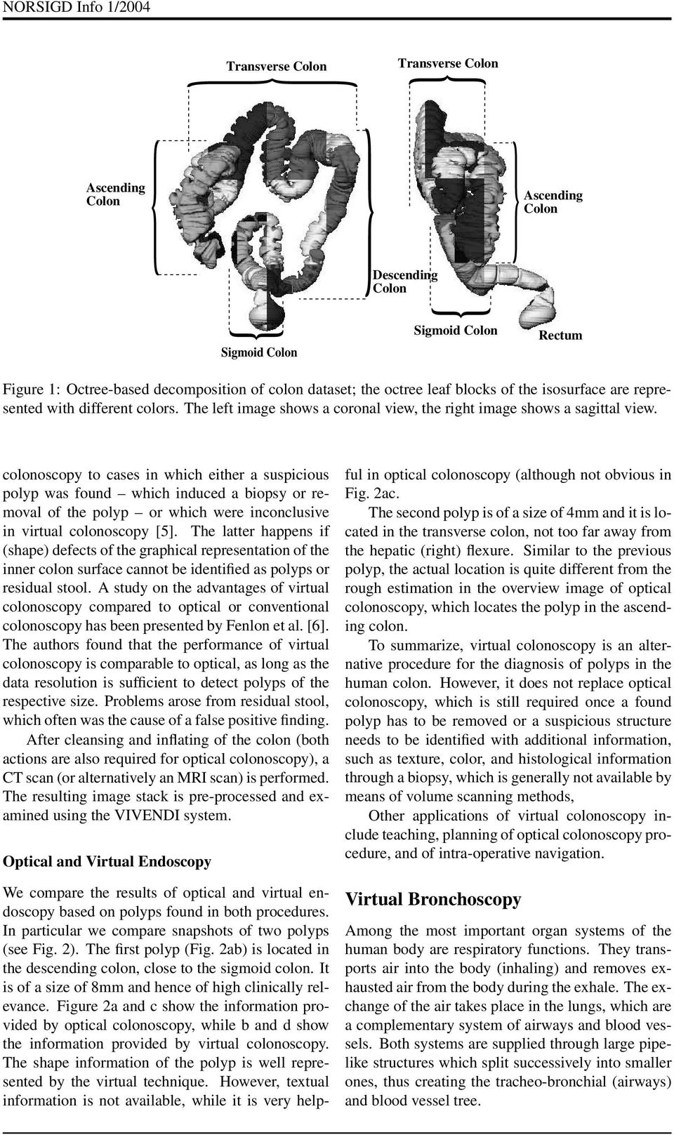 colonoscopy to cases in which either a suspicious polyp was found which induced a biopsy or removal of the polyp or which were inconclusive in virtual colonoscopy [5].