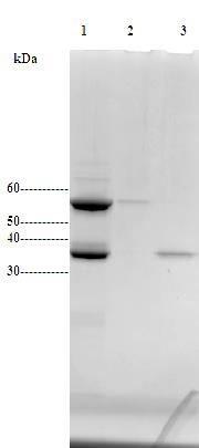 4. Resultater 4.5.2 Separasjon av his-tagget ChiC-E141Q med HIC ChiC-E141Q ble renset med HIC, som beskrevet i avsnitt 3.4.2, for å isolere det proteolytiske produktet ChiC2-E141Q fra ChiC-E141Q.