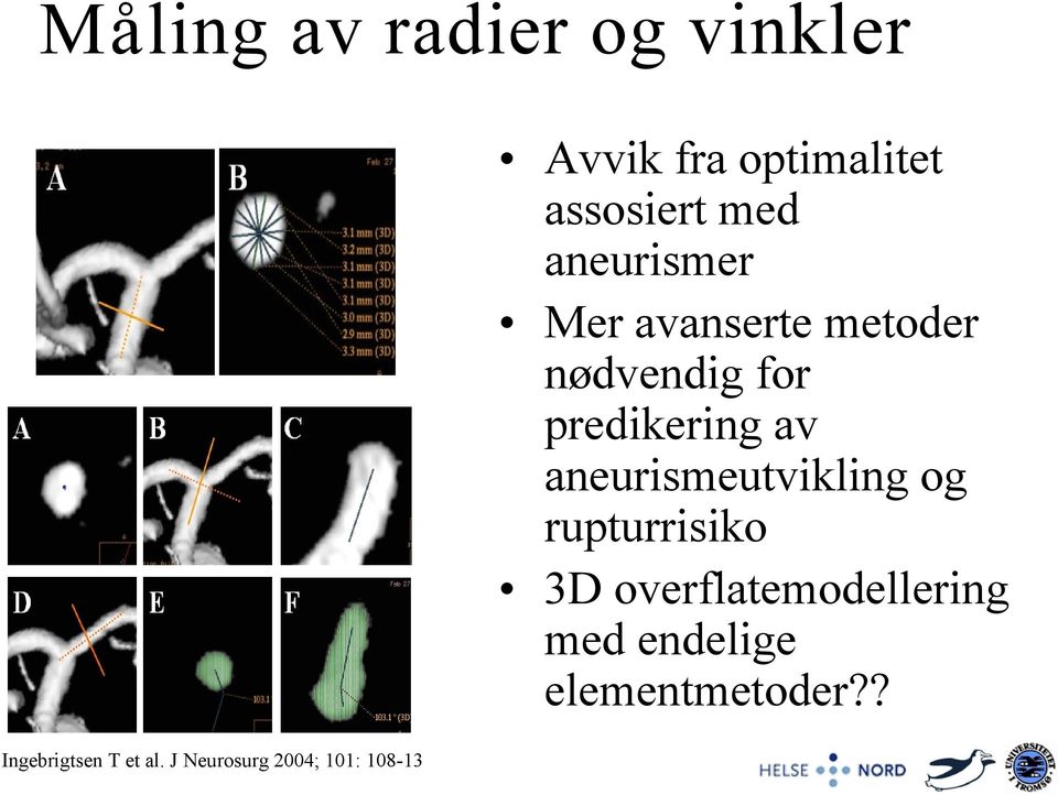 aneurismer Mer avanserte metoder nødvendig for predikering av