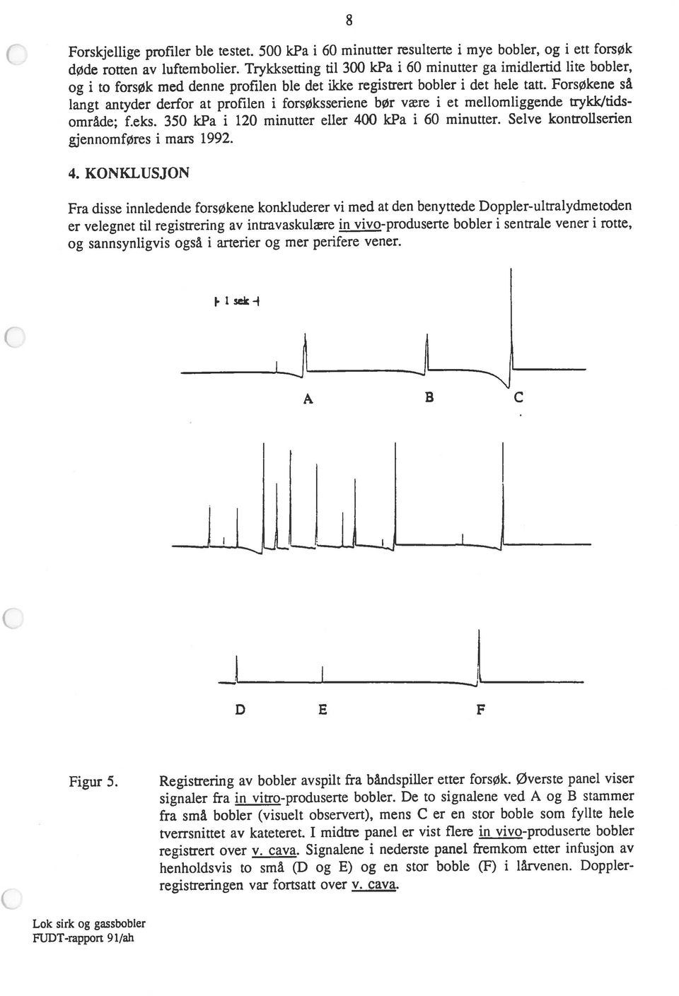 De to signalene ved A og B stammer fra små bobler (visuelt observert), mens C er en Stor boble som fylke hele registrert over v. cava.