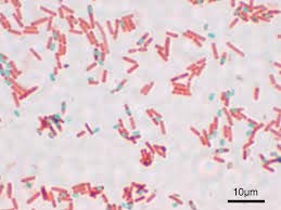 Våre indikatorer Prokaryote celler Gram-positive, termofile