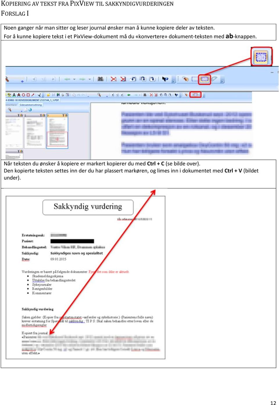 For å kunne kopiere tekst i et PixView-dokument må du «konvertere» dokument-teksten med ab-knappen.