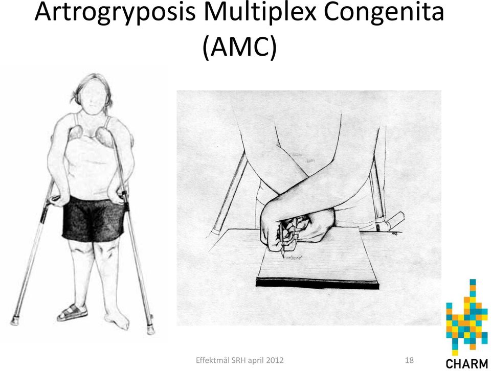 Congenita (AMC)