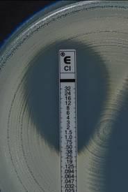 3 Agar gradientdiffusjon Ved agar gradientdiffusjon brukes plast- eller papirstrimler impregnert med en predefinert antibiotikagradient.