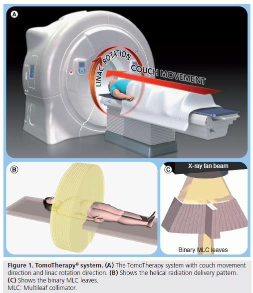 Tomotherapy Tomoterapi er en stråleterapi-modalitet som ble utviklet på 1990-tallet. Første pasient ble behandlet i 2002 (University of Wisconsin).