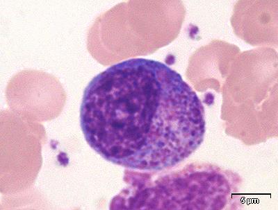 Myelopoiese: Myeloblast 10-20 μm i diameter Lys, finstrukturert kjerne (mye ekstendert kromatin) Har nukleoli (oppklaringer i kjernen) og lyseblått cytoplasma uten korn Promyelocytt 15-20 μm i