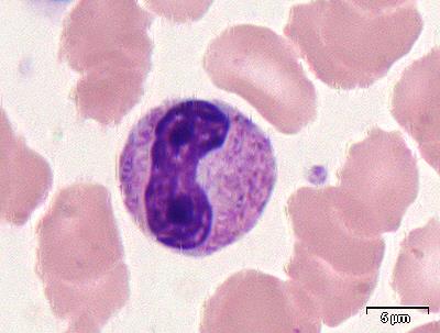 Myelocytt 12-18 μm i diameter Kjernern har småklumpet kromatin og ikke nukleoli Cytoplasma er lysere og med ulike typer korn (azurofile og "spesifikke" korn) Azurofile korn bare syntesisert i