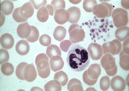 Stavkjernet nøytrofil granulocytt 9-15 μm i diameter U-formet cellekjerne med runde ender Normalt finnes det ca 5% av disse i blodet Segmentert