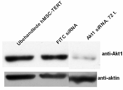 3.1.2.3 Transfeksjon av hmsc-tert med SMARTpool-siRNA Med bakgrunn i resultatene i figur 3.1.2.2 og 3.1.2.3 på side 52 ble det neste målet å undersøke om det var mulig å redusere genekspresjonen av flere utvalgte sentrale signalproteiner ved hjelp av RNAi.