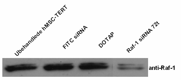 Raf sirna transfekterte hmsc-tert ble analysert med Raf-1 spesifikt antistoff. Figur 3.1.2.7 I de transfekterte cellene var det en kraftig nedgang i Raf-1-uttrykk etter inkubasjon i 72 timer.
