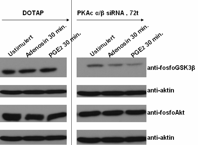 Cellene ble transfektert med PKAc sirna. Figur 3.2.1.