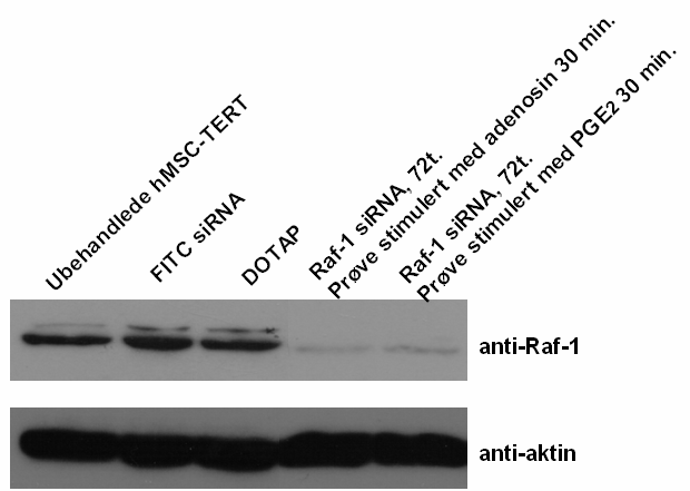 Først ble cellene transfektert med Raf-1 sirna eller PKAc sirna. Figur 3.