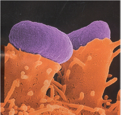 Nasjonal referansefunksjon for næringsmiddelbårne bakterier Salmonella