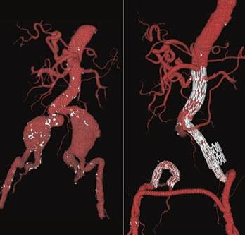 INTERVENSJONSRADIOLOGI (IR) Søknad om godkjenning av