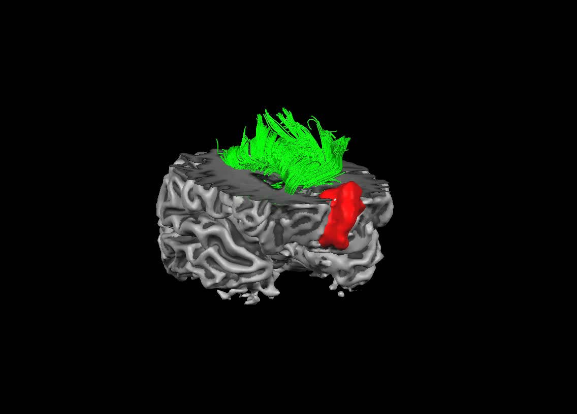 MR-fysikerens oppgaver 3D-modellering av