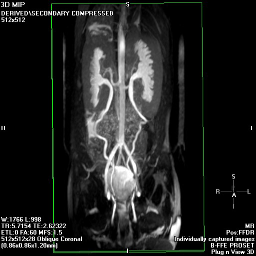 Muligheter Abdomen Fremstilling av aorta