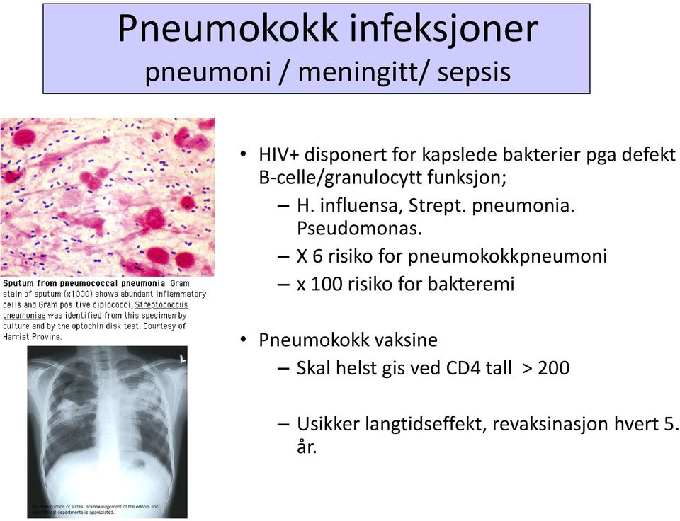 Pseudomonas.