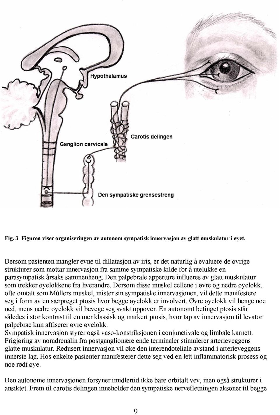sammenheng. Den palpebrale apperture influeres av glatt muskulatur som trekker øyelokkene fra hverandre.