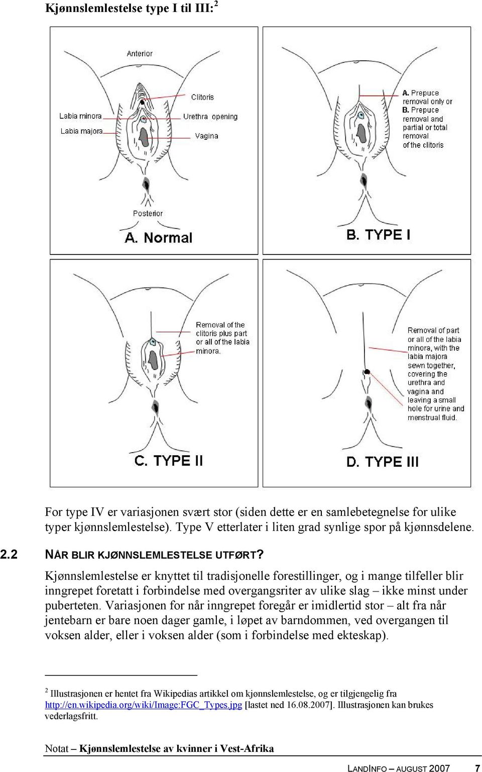 Kjønnslemlestelse er knyttet til tradisjonelle forestillinger, og i mange tilfeller blir inngrepet foretatt i forbindelse med overgangsriter av ulike slag ikke minst under puberteten.