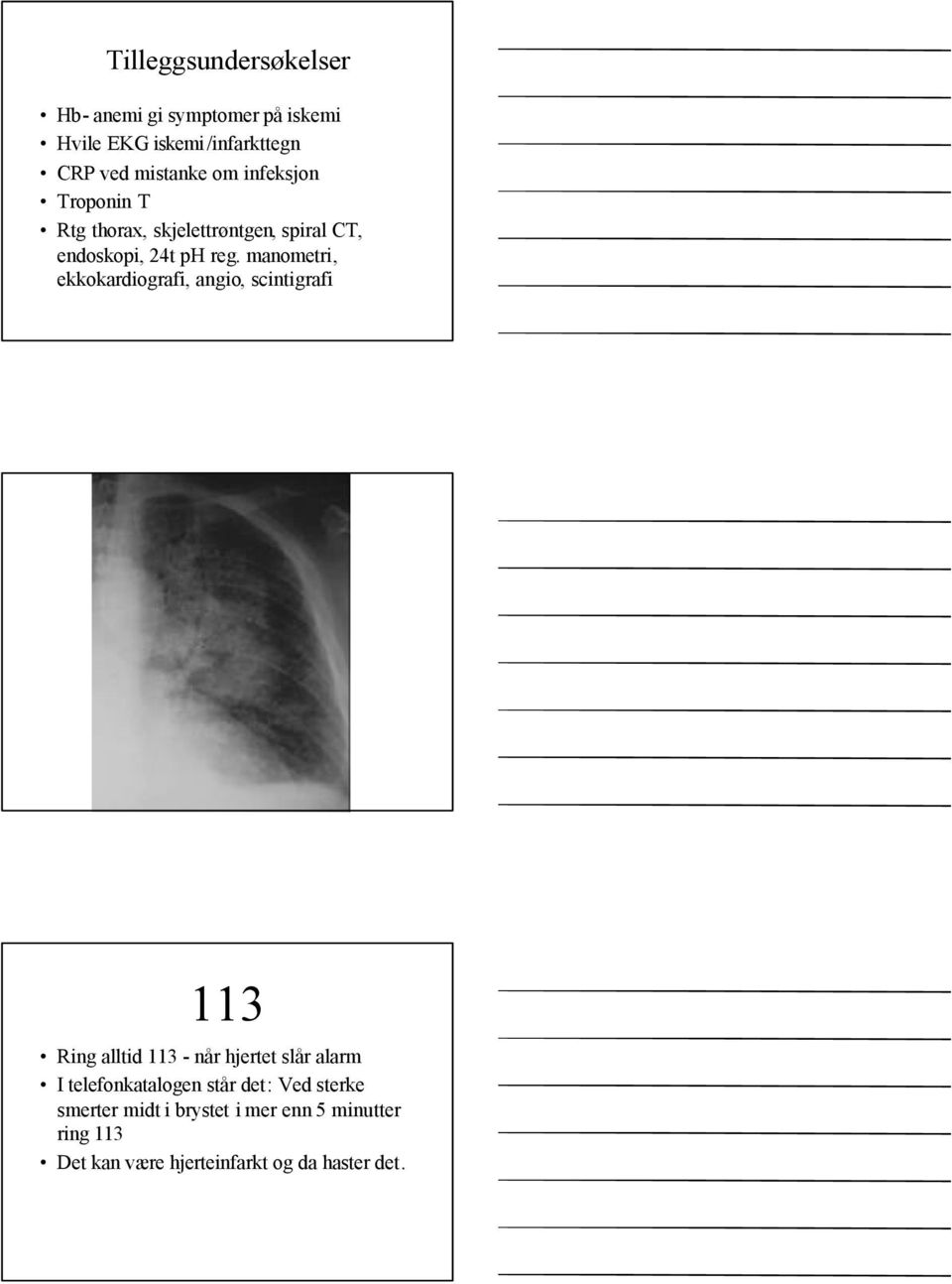 manometri, ekkokardiografi, angio, scintigrafi 113 Ring alltid 113 - når hjertet slår alarm I